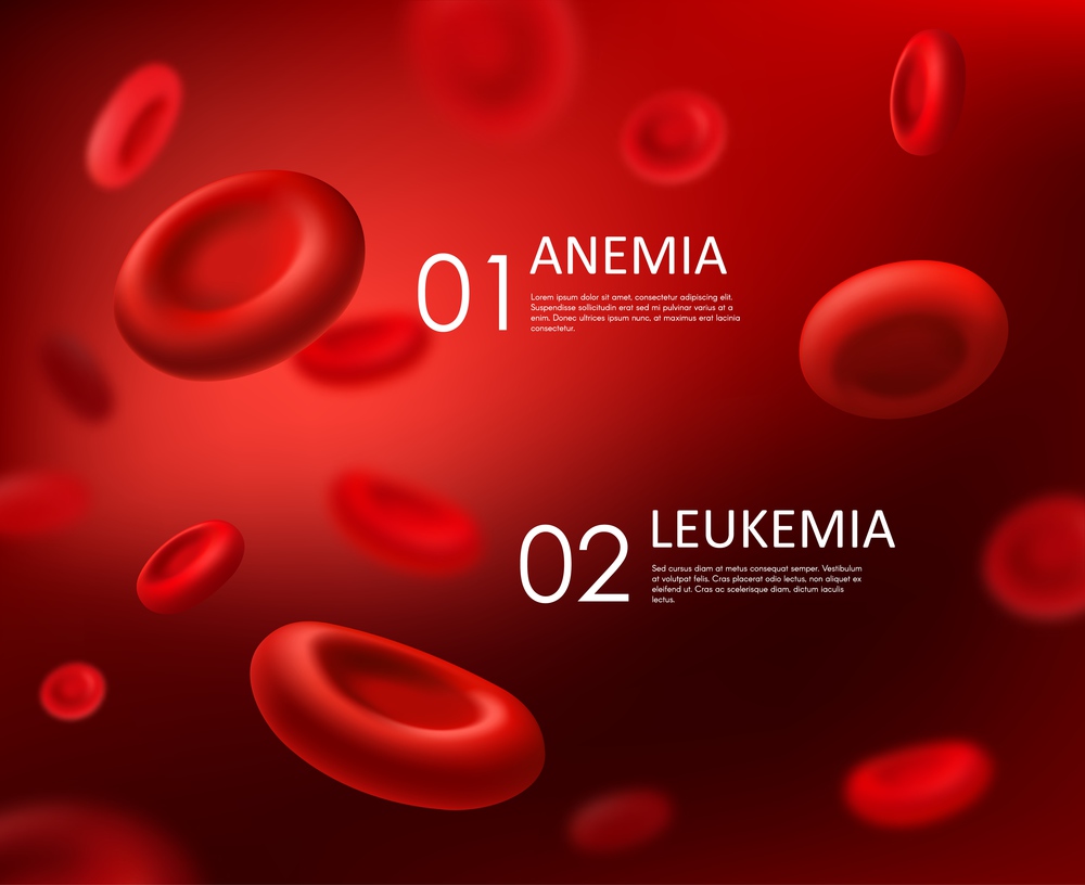 Anemia and leukemia, blood diseases vector background with red cells erythrocytes. Healthcare and hematology medicine, anemia and leukemia diseases, hemoglobin blood cells deficiency. Blood anemia and leukemia diseases, red cells