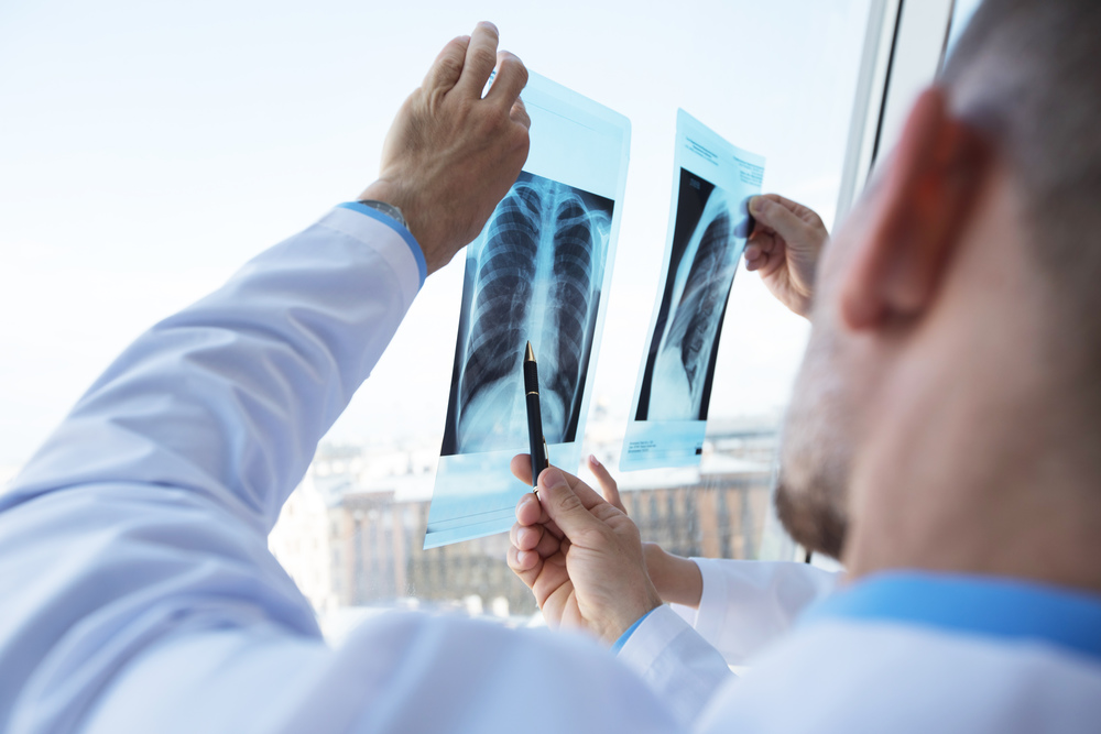 Healthcare, medical: Group of doctors discuss and looking x-ray in a clinic or hospital. Doctors discuss and looking x-ray