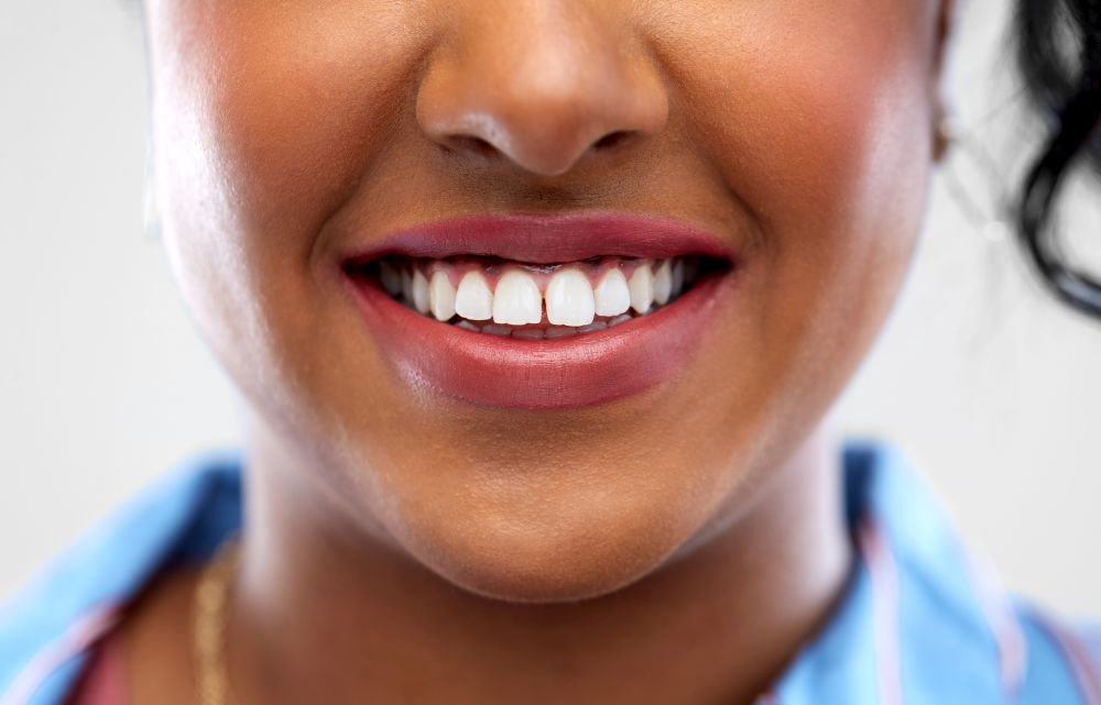oral care, dental hygiene and people concept - close up of african american woman face with smile and white teeth. close up of african american woman white teeth