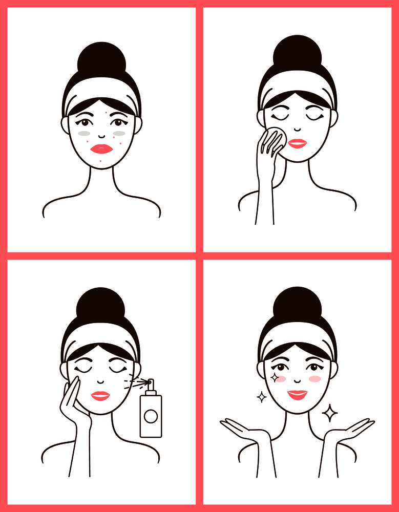 Young woman with acne applies fresh tonic from spray bottle and heals her skin isolated cartoon flat vector illustrations set on white background.. Young Woman with Acne Applies Fresh Tonic Set