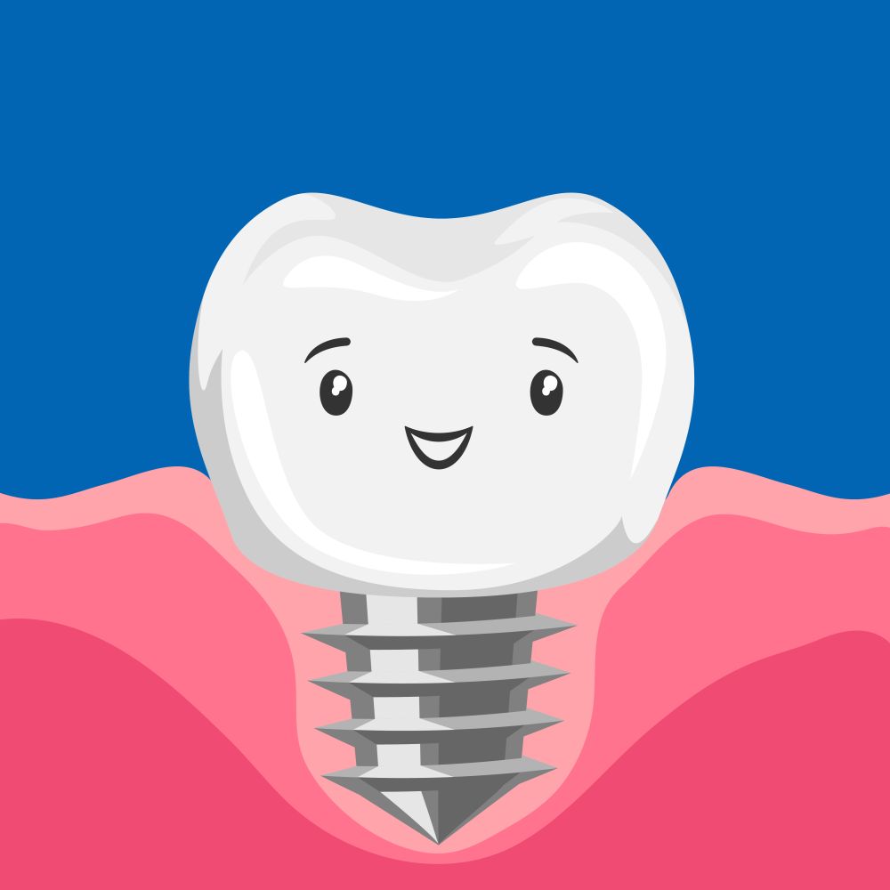 Illustration of ssmiling tooth implant. Children dentistry happy character. Kawaii facial expression.. Illustration of smiling tooth implant.