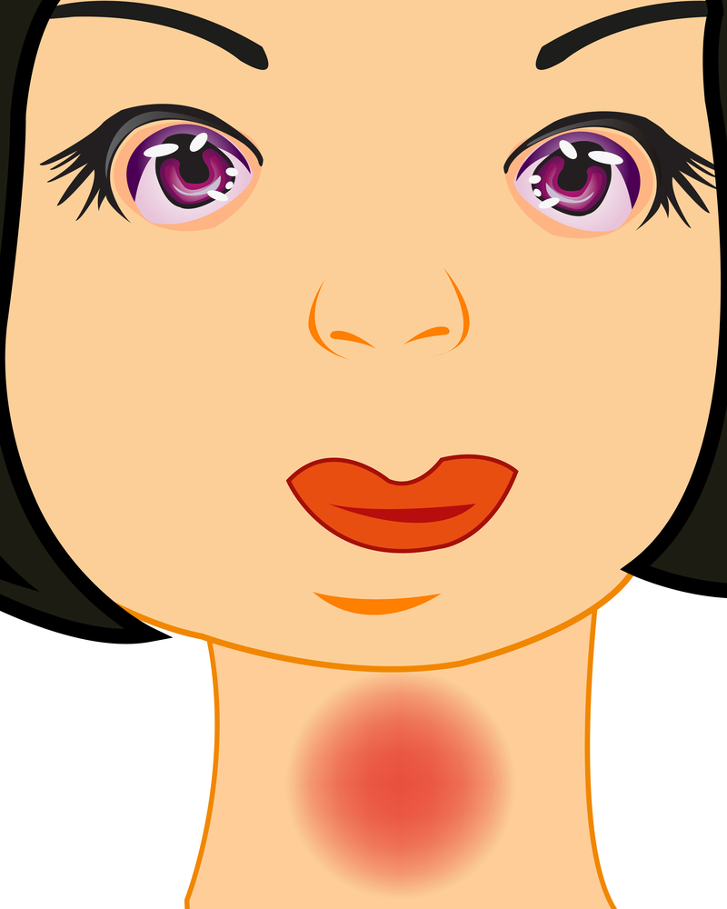 Girl with sick throat on white background is insulated. Vector illustration of the girl with pain in throat