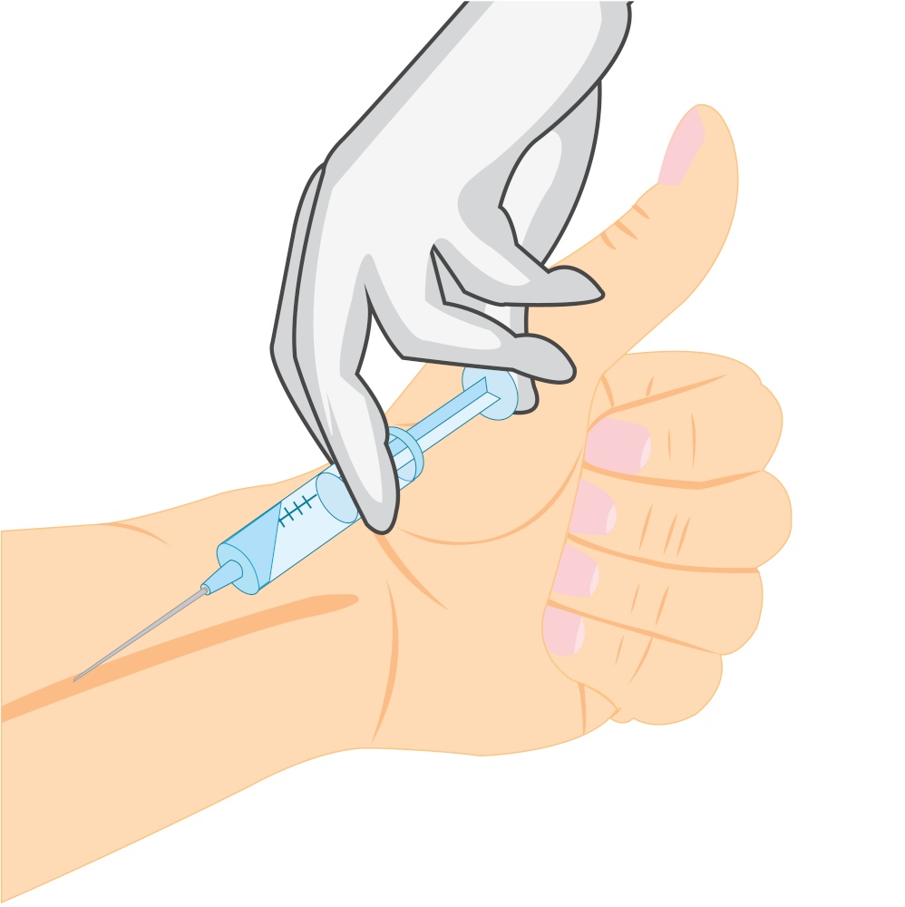 Vector illustration of the hand with syringe doing prick in vein. Doctor does prick in vein of the hand