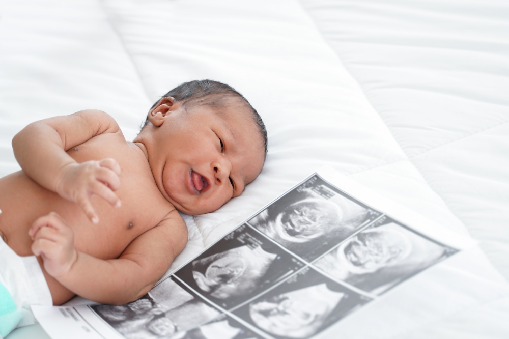 Portrait of African new born baby with diaper lying on bedroom with fetal ultrasound image for pregnancy. White background