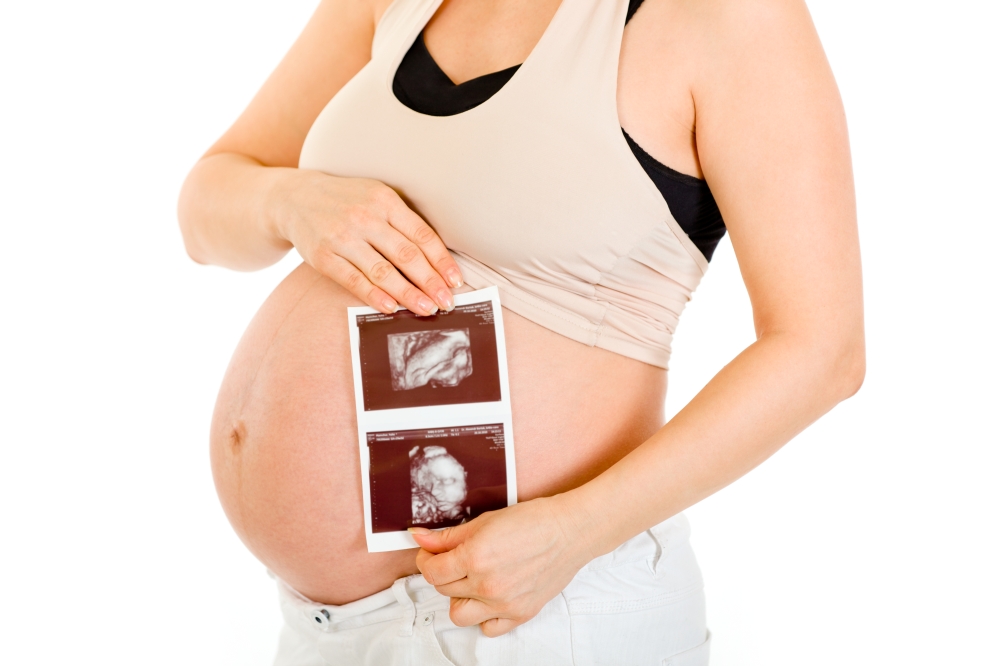 Pregnant woman holding echo in hands isolated on white. Close-up.&#xA;