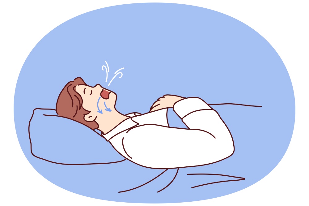 Man dozing on back in bed snores and has problems during obstructive sleep apnea. Guy suffering from obstructive sleep apnea with arrows on face pointing to airways that promote snoring. Man dozing on back in bed snores and has problems during obstructive sleep apnea